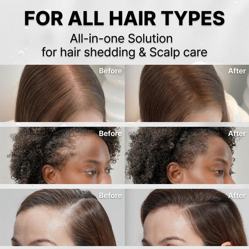Hair Growth Serum with Massage Brush